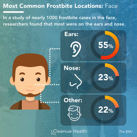 Most Common Frostbite Locations Infographic