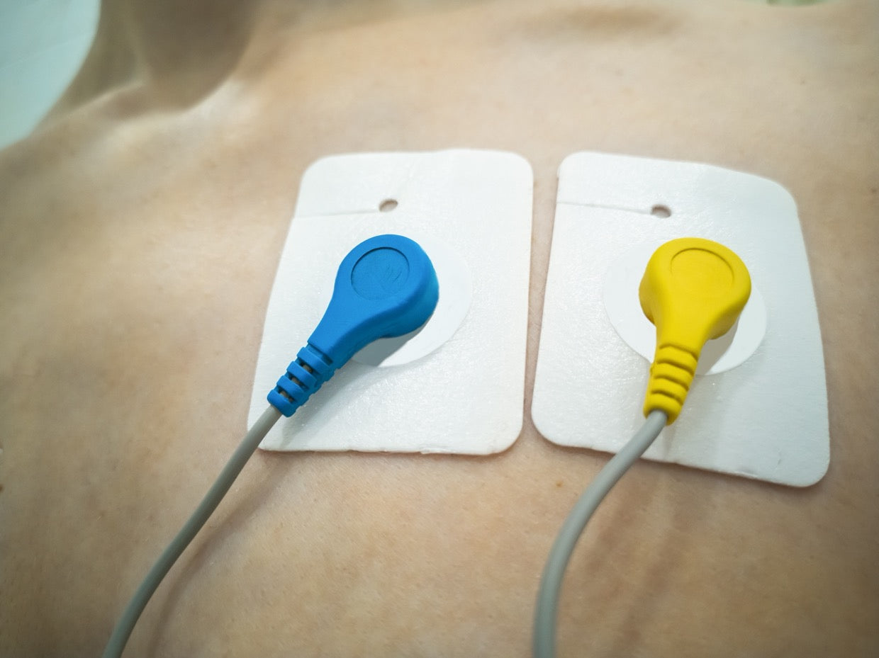 close up of blue and yellow Holter sensors