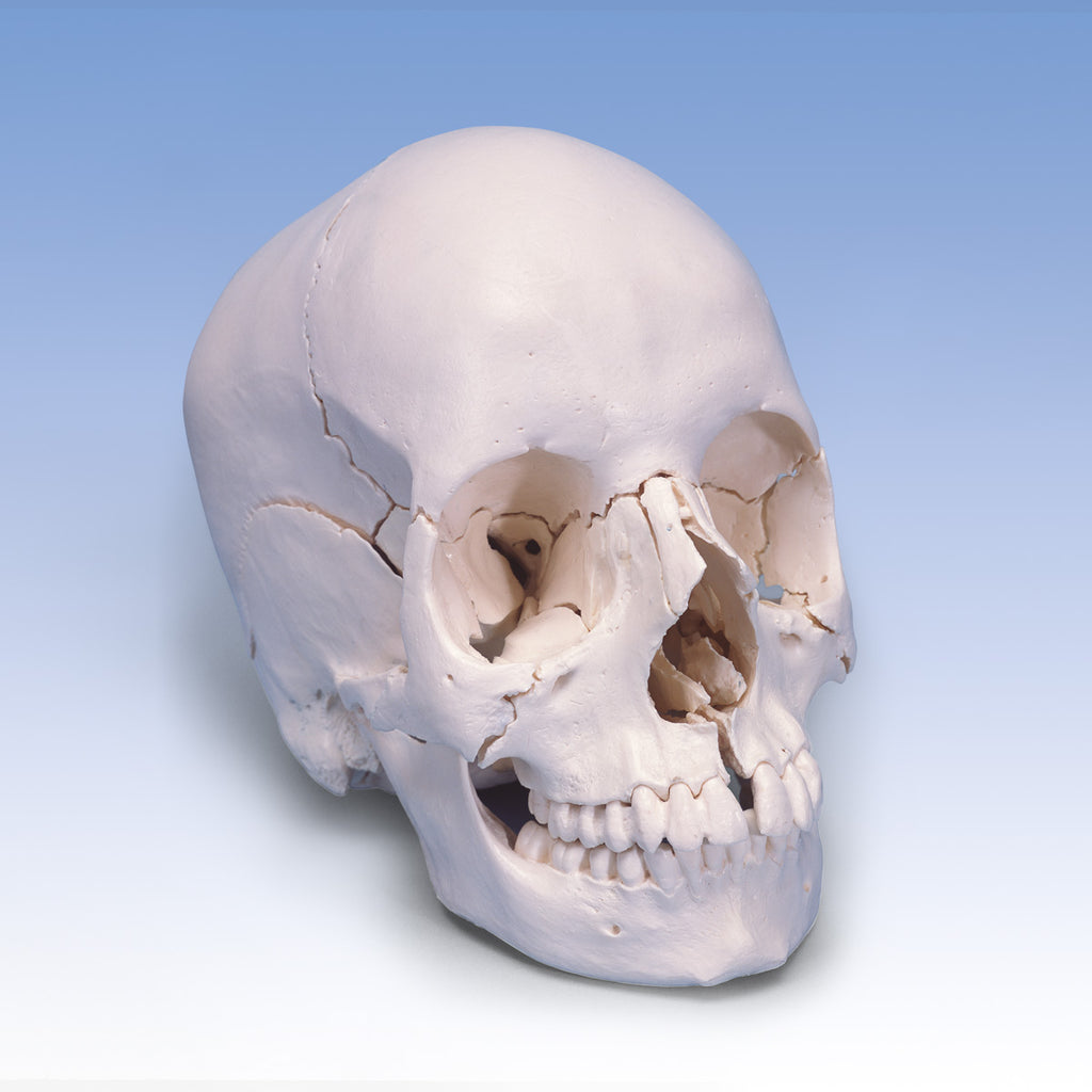Реконструкция костей черепа