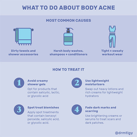 ¿Qué hacer con el acné corporal?