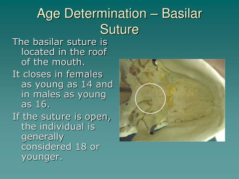 Basilar suture