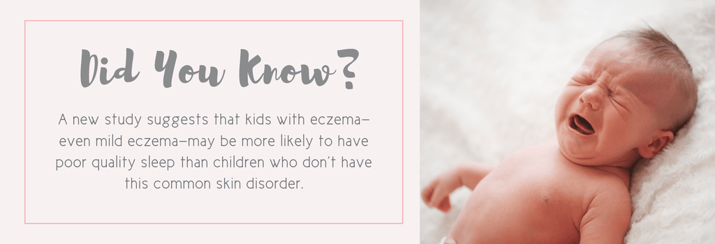 baby-with-eczema-not-sleeping-new-study