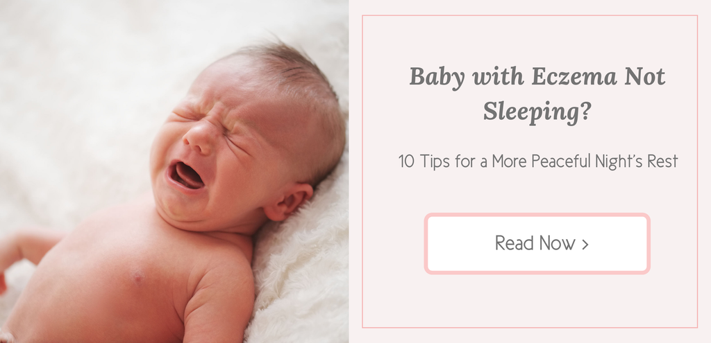 baby-with-eczema-not-sleeping