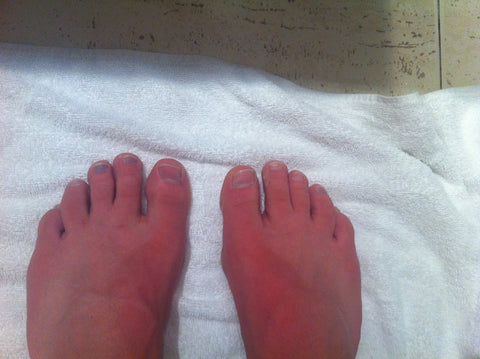 4 black toenails after my first "full" in Mallorca, 2014