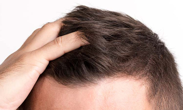 Scalp Inflammation: What is it and how to treat it? 