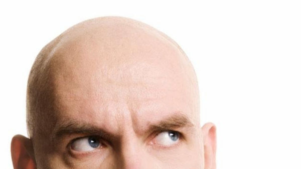 What Causes  Hair Loss In Men & What’s The Cure For It?