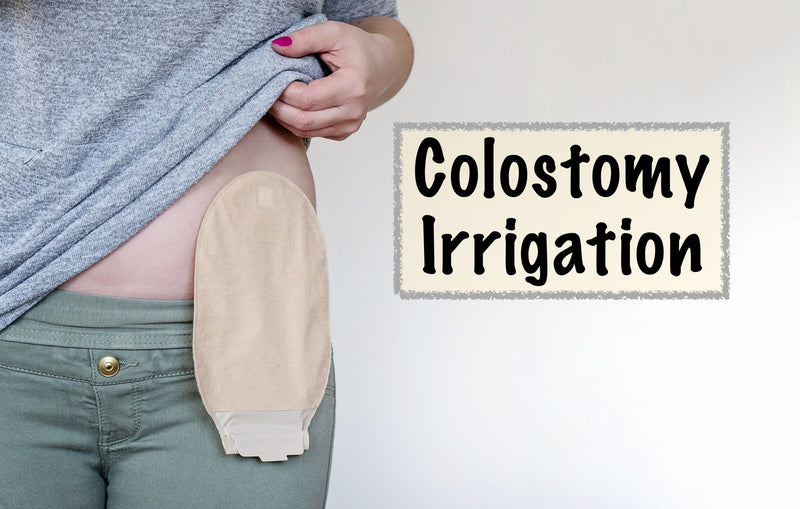 How to Do a Colostomy Irrigation A StepbyStep Guide