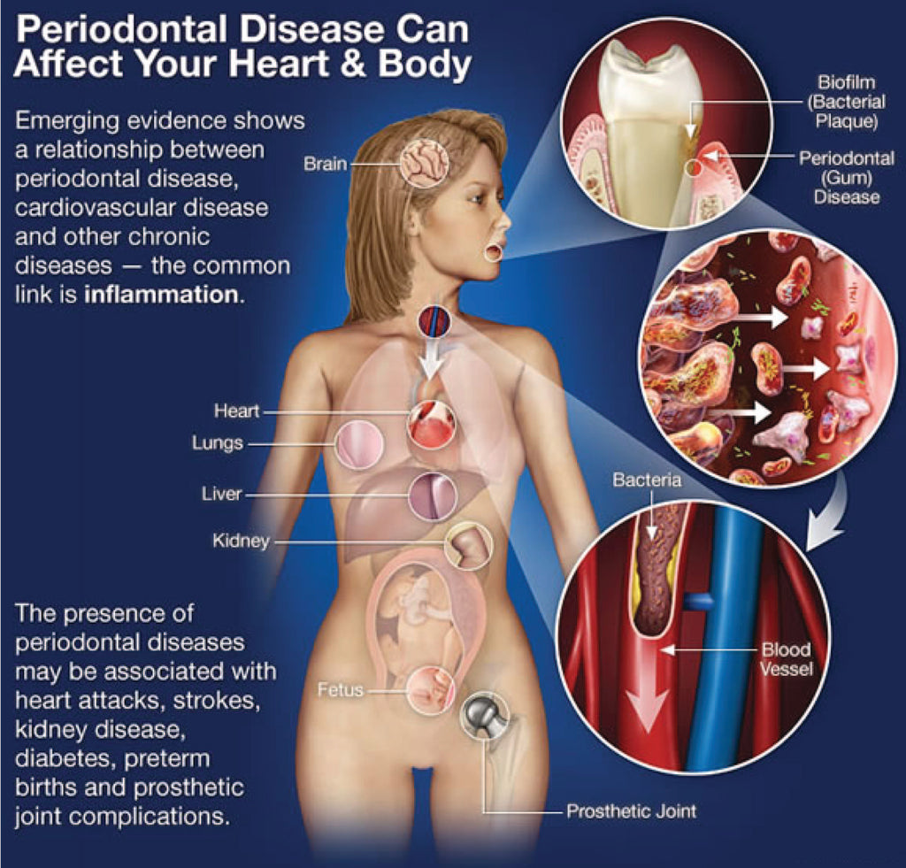 oral-systemic connection