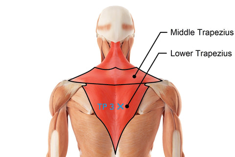 Trapezius muscle pain & trigger points