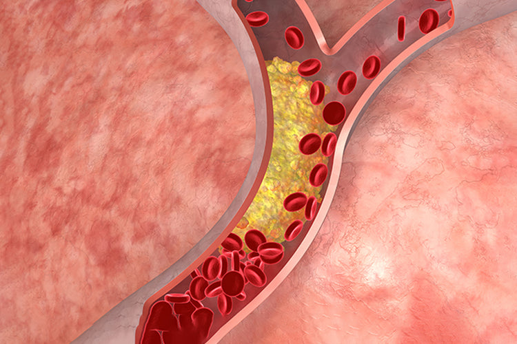 What is Cholesterol?