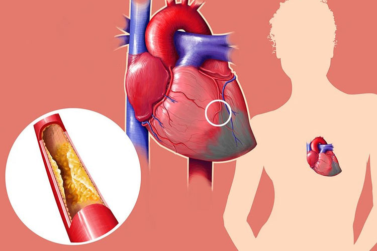 6. Decreases Cholesterol Levels