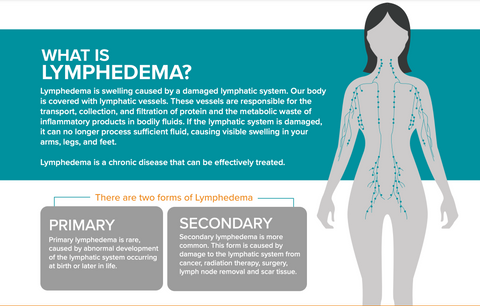 What is Lymphedema? 