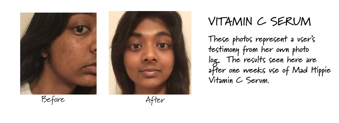 vitamin c serum before and after