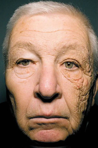 Man with sun exposure on left side of the face compared to right side | ALASTIN Skincare