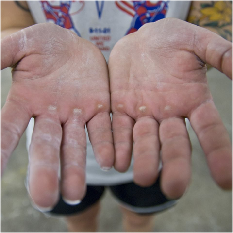 Hand and Callus Care Tips for Weight-lifting (Powerlifting