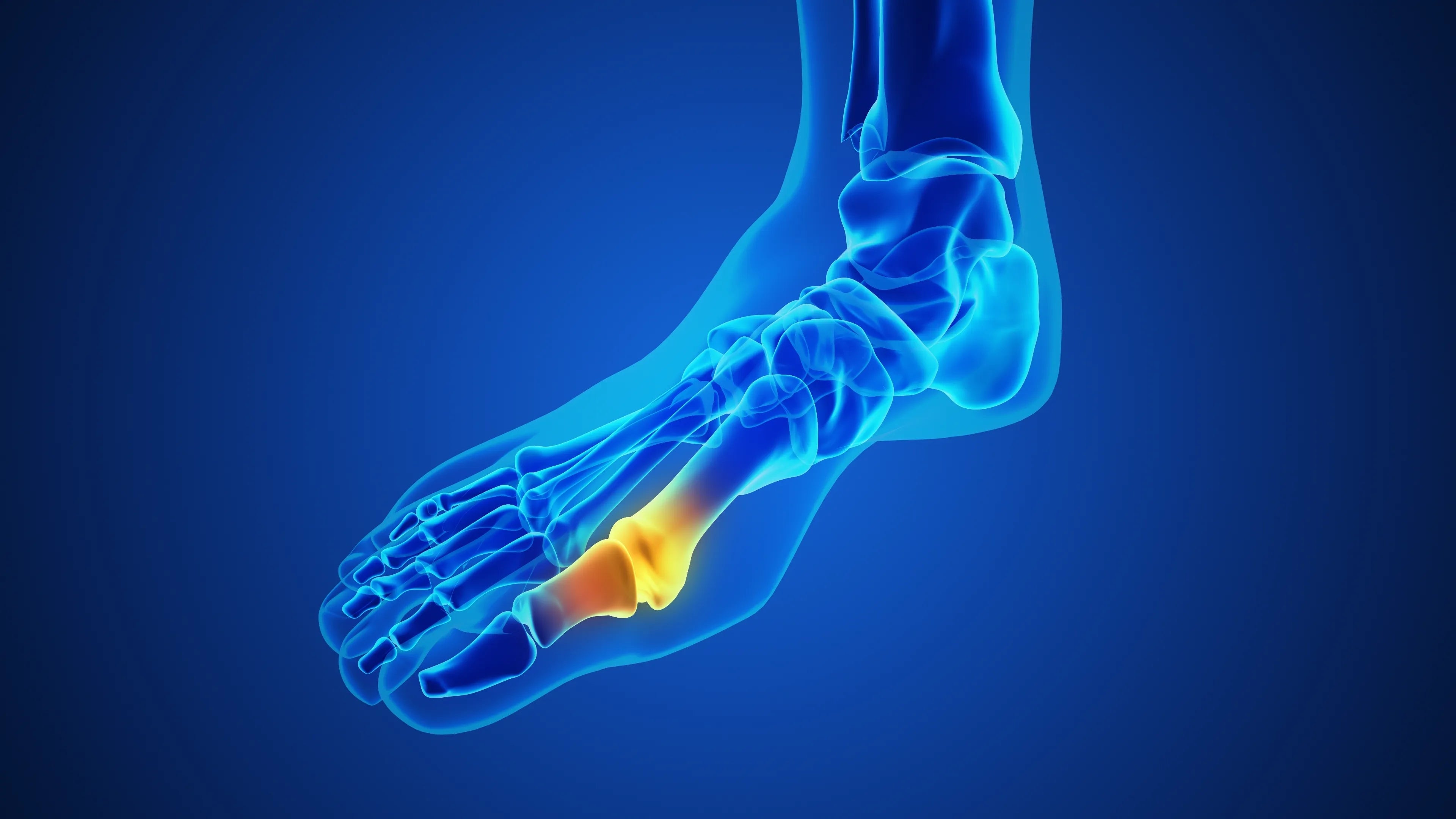 an illustration on what a gout is.