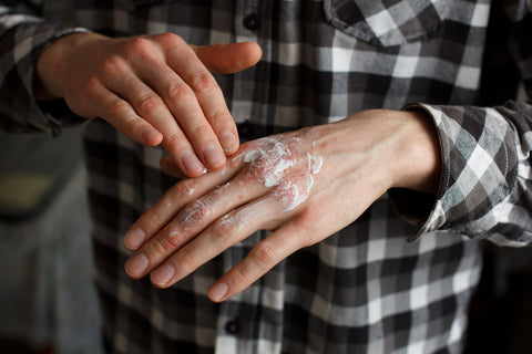 applying lotion to chapped hands