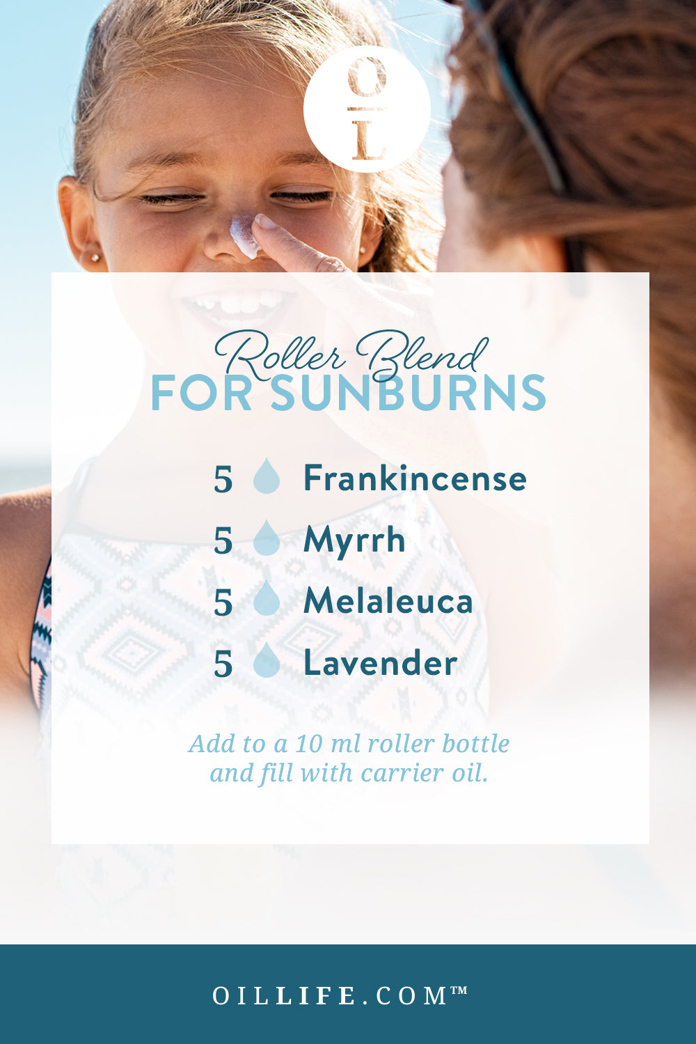 Roller Blend for Sunburns