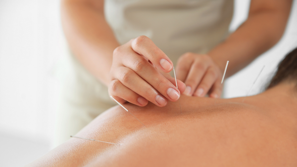 Alternative therapies like acupuncture may help with anxiety