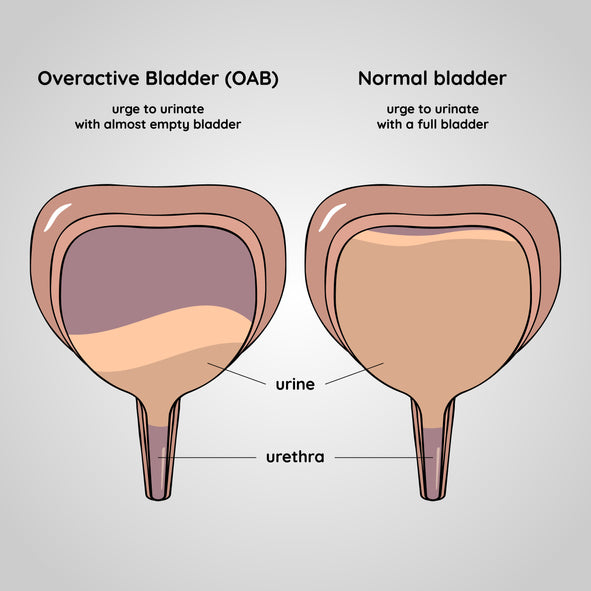 Overactive bladder vs normal bladder