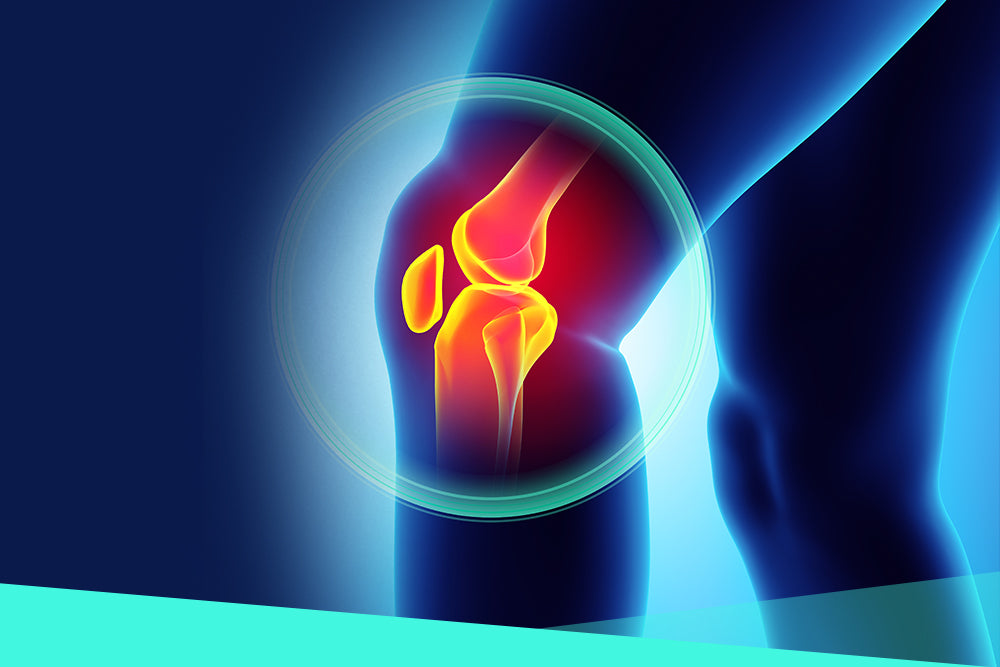 What is Knee Osteoarthritis?