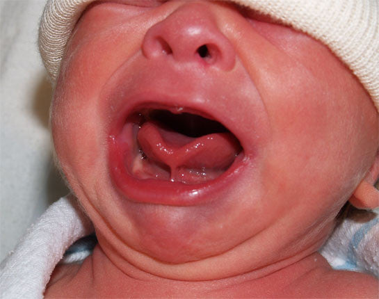 colic and reflux nhs
