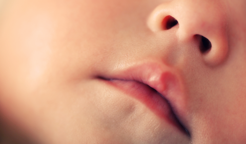 Does a Lip-Tie or Tongue-Tie Affect Bottle-Feeding?