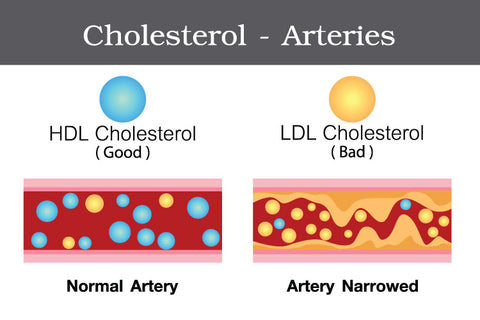 Good and Bad Cholesterol (LDL and HDL)