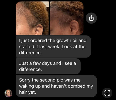 Tree Naturals Hair Growth Oil Results