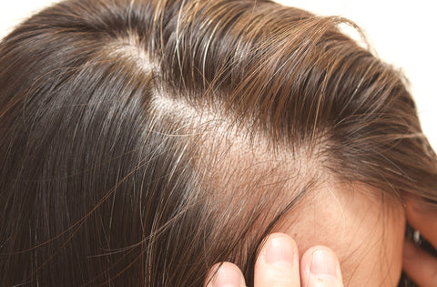 close up of the scalp of a woman with thinning brown hair