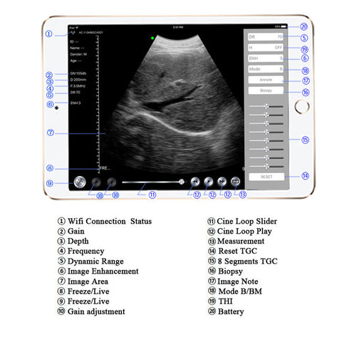 wireless ultrasound probes use App based software