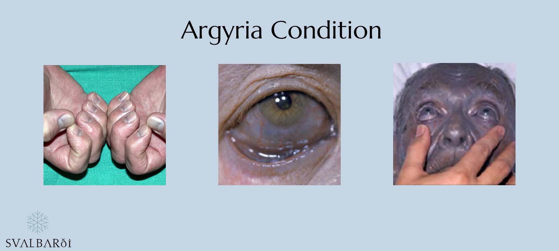 The Effects of Argyria Condition in Humans