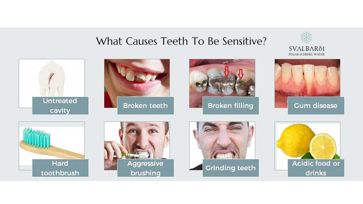 Causes of Teeth Sensitivity