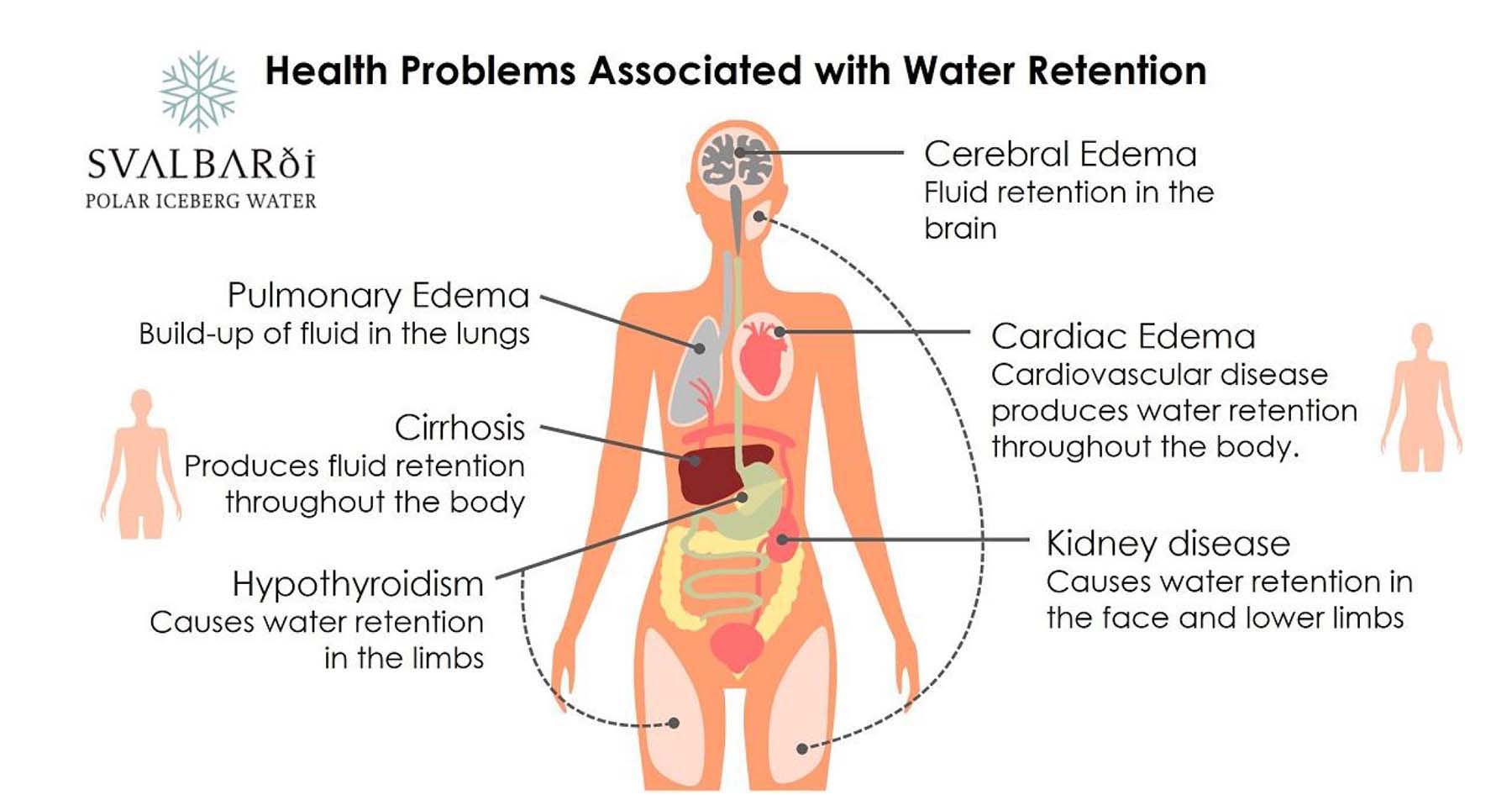 Health Problems Associated with Water Retention