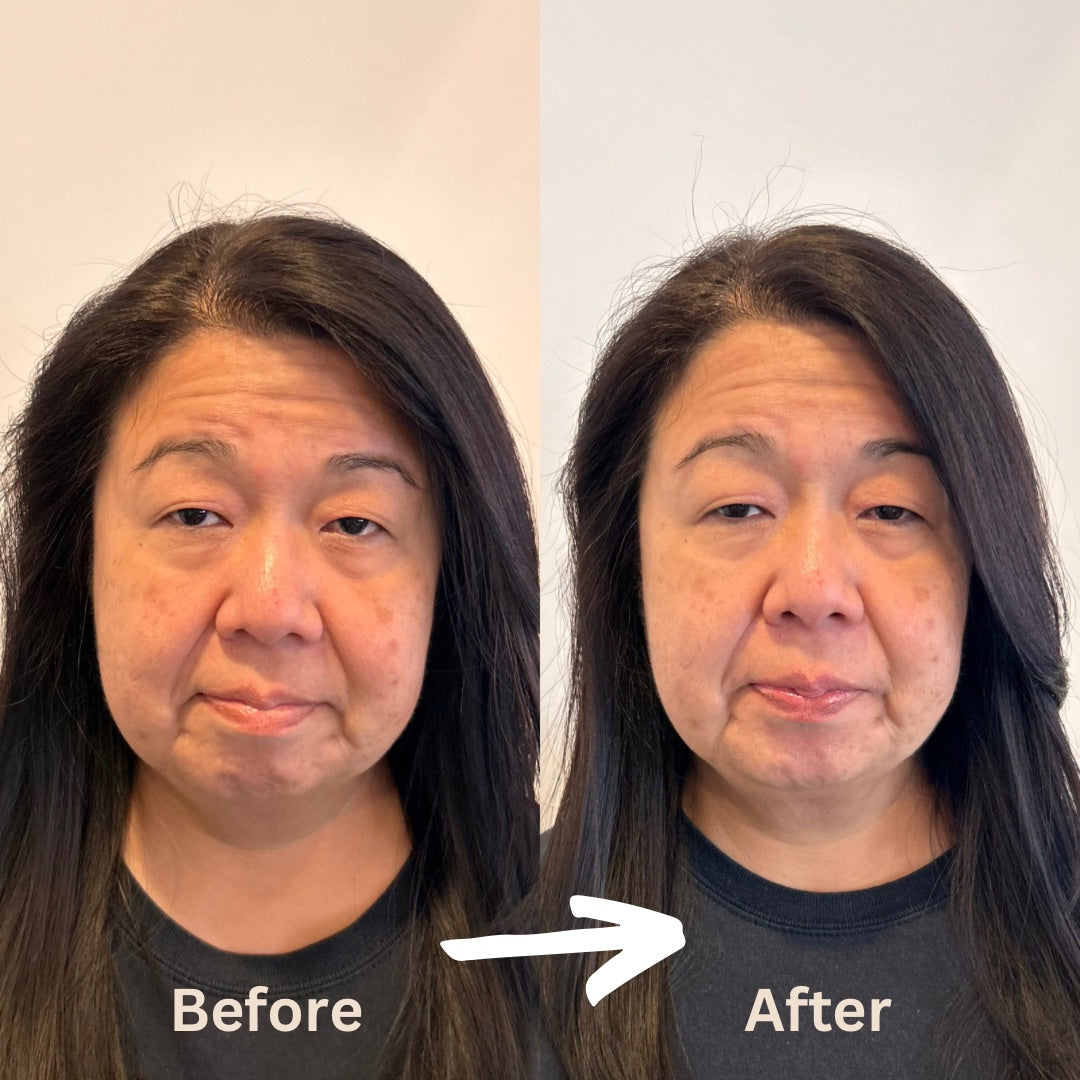 Facial1-before-after2.jpeg__PID:b3522608-2a4e-4a14-b101-fcd8d3c9f949