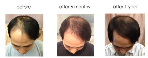  "I thought I would be completely bald in the future, but I tried using it as my last wish." Testimonials by Mr. M