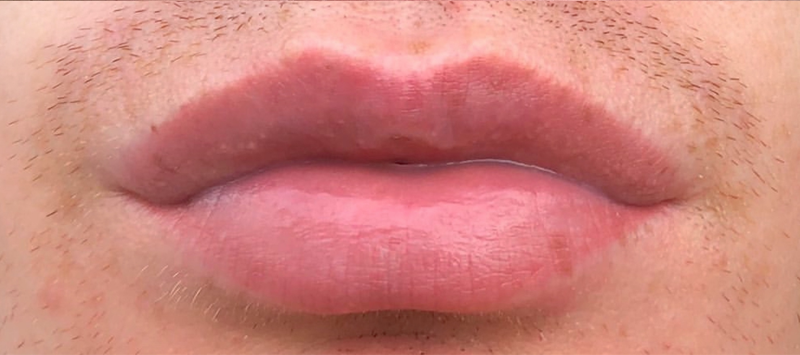 Male Clients Lip Blush Procedure Healed