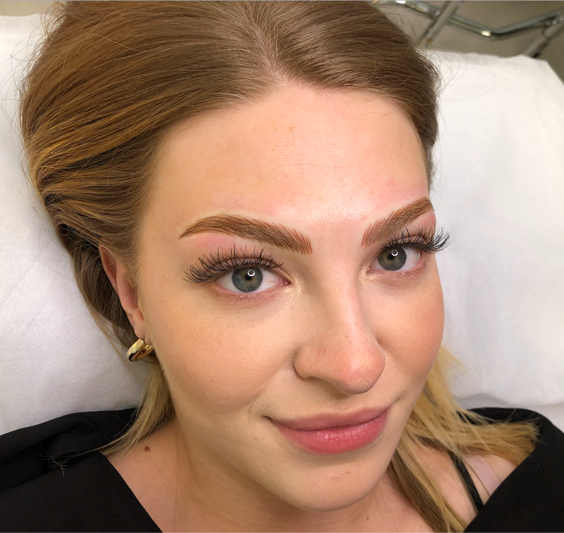 Megan Immediately After Microblading and Microshading Procedure