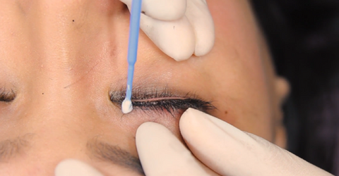 Mini Eyeliner Procedure Outline Numbing