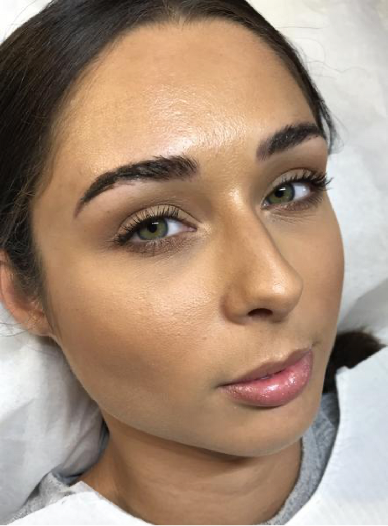 Brianna Day 5 After Microblading Procedure