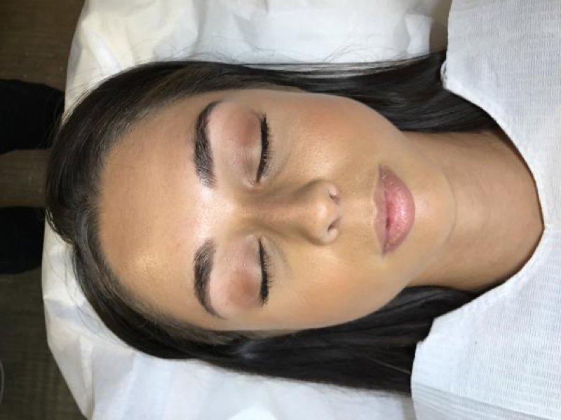 Brianna After Microblading Procedure Healing Day 5-7