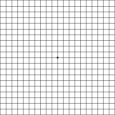 Amsler Grid 