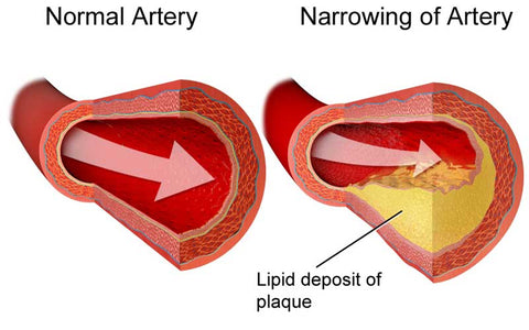 How To Reduce Cholesterol Naturally