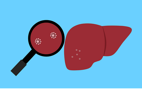 hepatitis liver disease