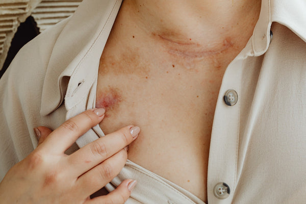 scars and bruises on woman