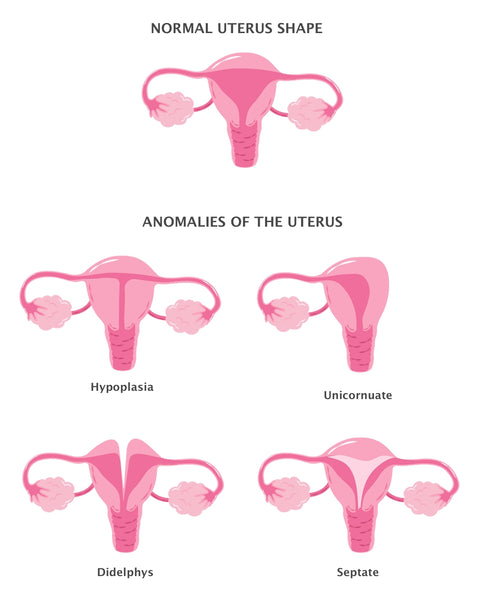 uterus shapes