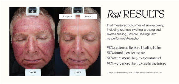Post-Procedure recovery before and after picture of man who of man who applied Aquaphor on left side of face and Doctor Rogers Restore Healing Balm on right side of face for 4 days and compared skin healing. 