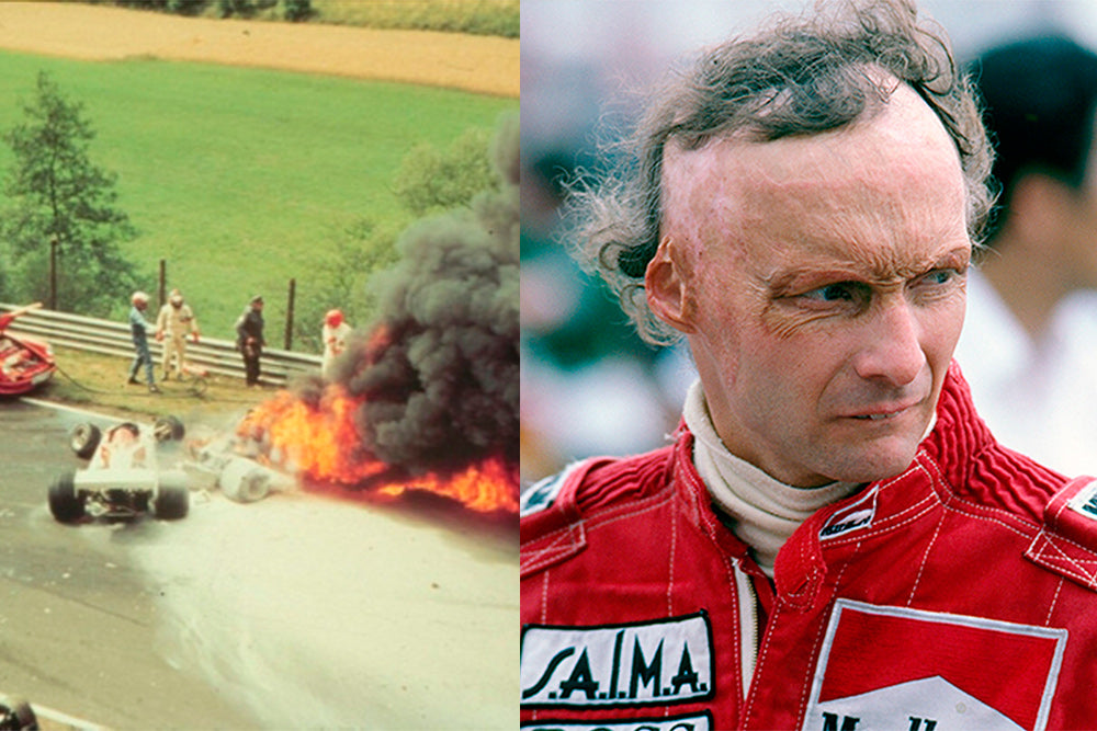 niki lauda accidente the indian face