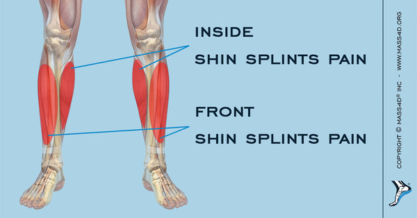 orthotics for shin splints