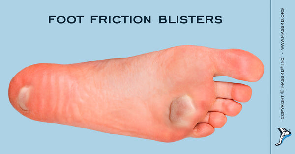 insoles for blisters
